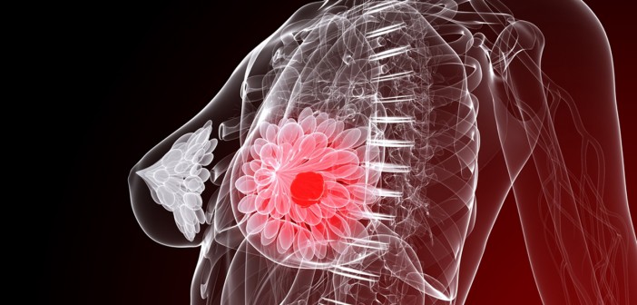 breast-cancer-702x336